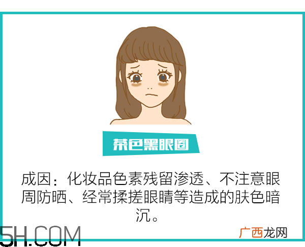 黑眼圈怎么去除既简单有容易 看类型与程度