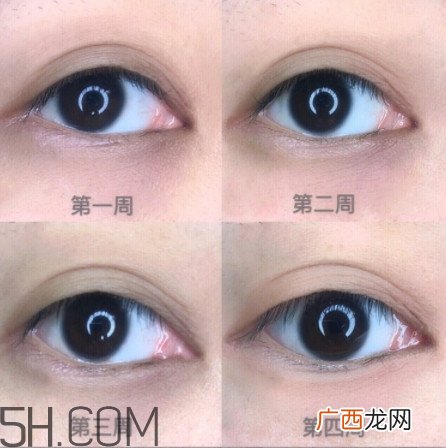 黑眼圈怎么去除既简单有容易 看类型与程度
