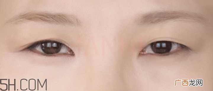 黑眼圈怎么去除既简单有容易 看类型与程度
