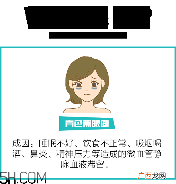 黑眼圈怎么去除既简单有容易 看类型与程度