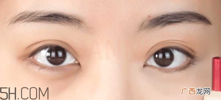 黑眼圈怎么去除既简单有容易 看类型与程度