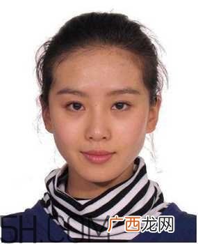 黑眼圈怎么去除既简单有容易 看类型与程度