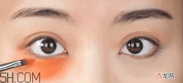 黑眼圈怎么去除既简单有容易 看类型与程度