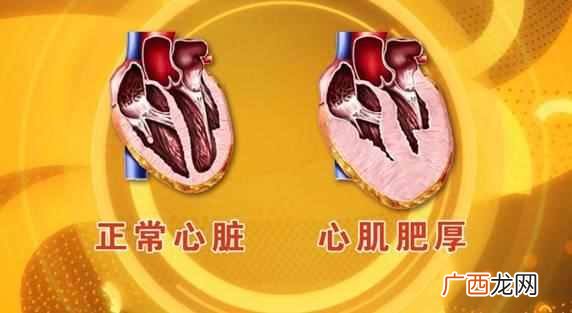 结节有哪些 结节是什么