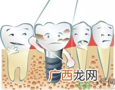 牙线会使牙缝变大吗?牙线会让牙缝变大吗?