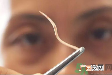 鱼刺卡在喉咙里怎么办？取鱼刺的小技巧有哪些？