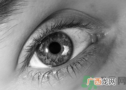 眼睛疼是怎么回事?眼睛疼怎么缓解妙招