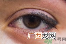 眼睛疼是怎么回事?眼睛疼怎么缓解妙招