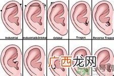 过敏体质能打耳洞吗？疤痕体质可以穿耳洞吗？