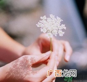 手指被门夹了有淤血怎么办？手指被门夹了有淤血怎么处理？