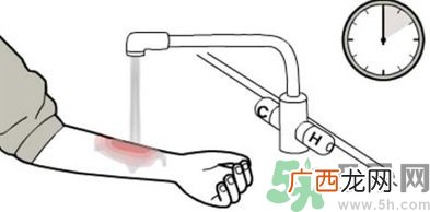 手被烫红了怎么办？手被烫了怎么止痛？