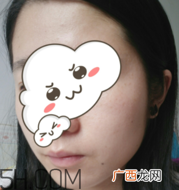 菲洛嘉21天美白精华多少钱_专柜价格