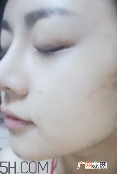 菲洛嘉21天美白精华多少钱_专柜价格