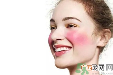 脸过敏发红痒怎么办？脸过敏发红痒擦什么药好？