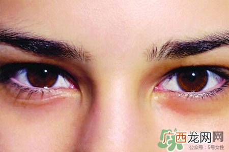 眼睛哭肿了怎么办？眼睛哭肿了如何快速消肿？