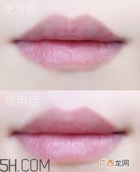 唇膜有什么副作用吗 使用唇膜也会过敏