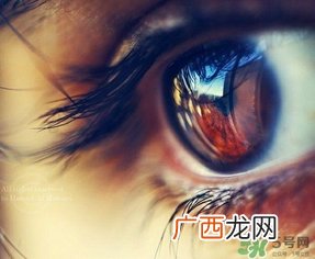 眼睛前面有黑影是怎么回事?眼睛前面有黑影是什么病?