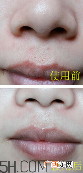 兰蔻美肤修护精华乳怎么样_好用吗
