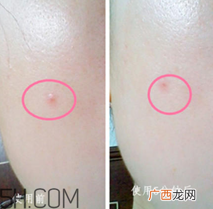 兰蔻美肤修护精华乳怎么样_好用吗