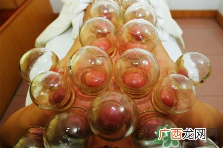 拔罐减肥为什么会反弹?拔罐减肥后不反弹的方法