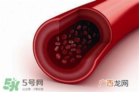 人造血管可以用多久?人造血管的护理