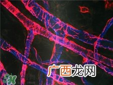 人造血管可以用多久?人造血管的护理