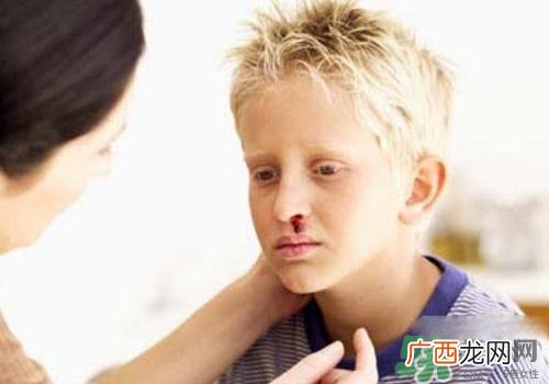 半夜流鼻血是什么原因?半夜流鼻血怎么办?