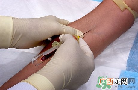 被狗咬了一定要打针吗?被狗咬了多长时间打针有效