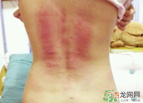 大便冲不掉是什么原因?大便冲不掉是癌症征兆吗