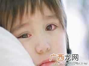 该怎么治疗红眼病 得了红眼病怎么办