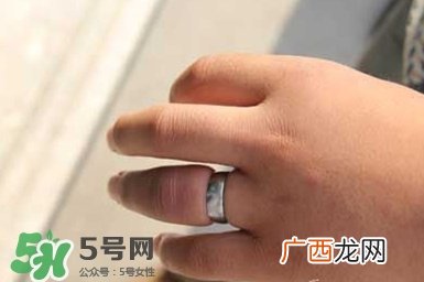 手指被戒指卡住了怎么办?手指被戒指卡住解救法
