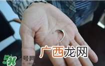 手指被戒指卡住了怎么办?手指被戒指卡住解救法