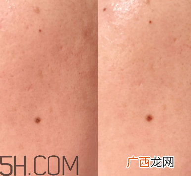 兰蔻美容液多少钱_兰蔻美容液功效