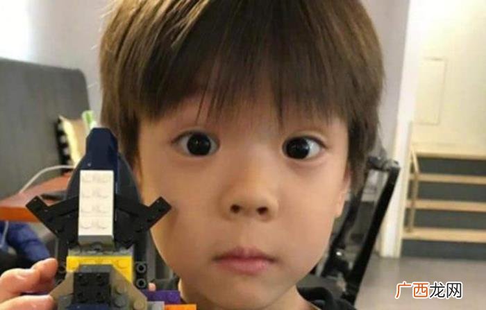 双眼皮变单,为什么婴儿的双眼皮会"单转双"或"双转单"