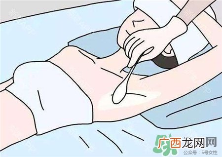 刮腋毛会引起狐臭吗?刮腋毛会不会有狐臭?