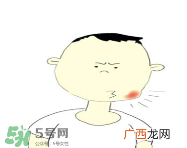 嘴角起泡是什么原因？嘴角起泡怎么办？