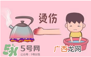 烫伤可以用牙膏吗？烫伤用牙膏管用吗？