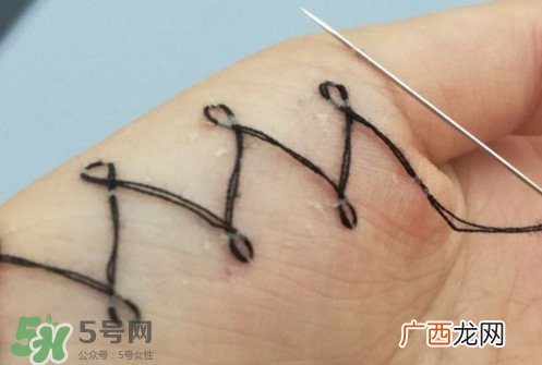 人体刺绣是自残吗？人体刺绣有什么危害