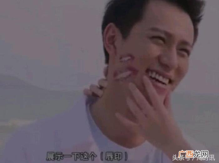 张雪迎吻痕，张雪迎让秦俊杰为自己擦脚、同吃一碗胡辣汤、晒吻痕