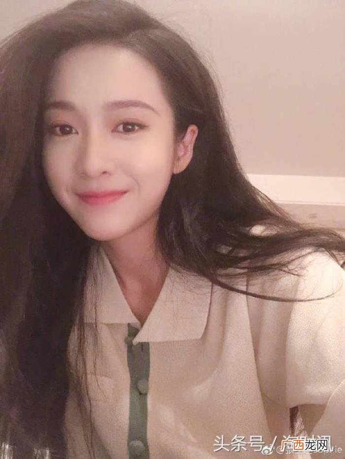 张雪迎吻痕，张雪迎让秦俊杰为自己擦脚、同吃一碗胡辣汤、晒吻痕