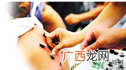 三伏贴要贴几次？三伏贴要贴多久？