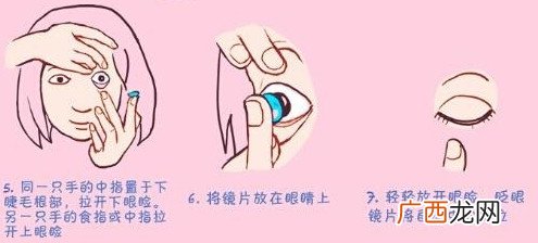 隐形眼镜怎么摘？戴隐形眼镜的好处和坏处