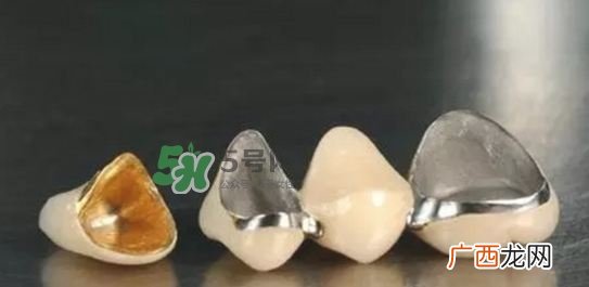 烤瓷牙和全瓷牙有什么区别?烤瓷牙和全瓷牙的区别