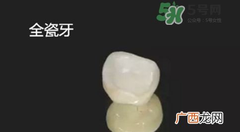 烤瓷牙和全瓷牙有什么区别?烤瓷牙和全瓷牙的区别