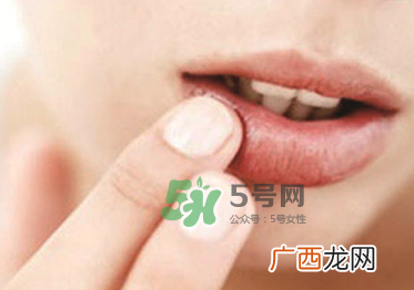 你的嘴唇为什么起泡嘴唇上的水泡治不好吗？
