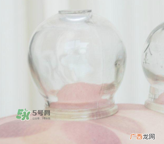 拔火罐能吹空调吗？拔火罐可以吹空调吗？