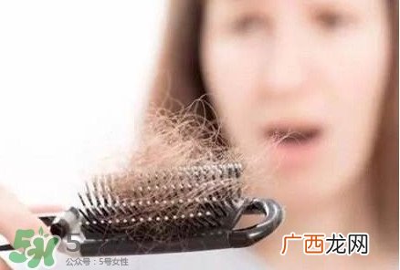 严重掉头发与洗发水有关吗？掉头发是洗发水的原因吗