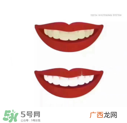 美牙仪能带上飞机吗？美牙仪可以过安检吗？
