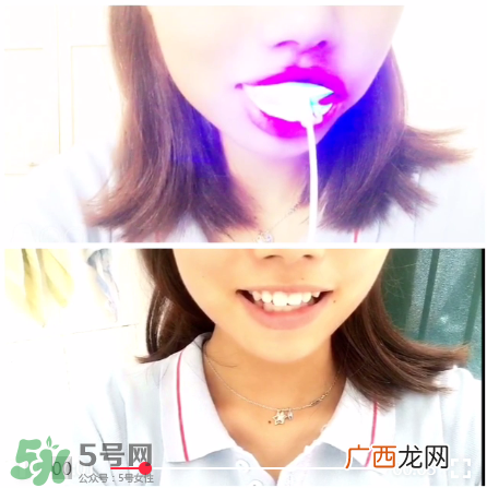 美牙仪能治氟斑牙吗？氟斑牙可以用美白仪吗？