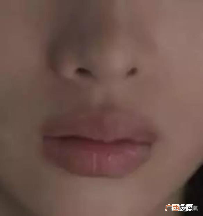 辛正蕾的嘴，辛芷蕾新剧里的嘴是玻尿酸丰唇失败变成三瓣嘴了吗